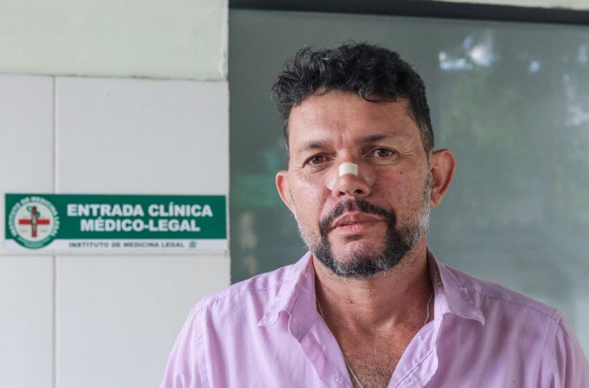 Família cobra responsabilização após jovem morrer eletrocutado por ligação clandestina em trailer no Recife Vinicio Wendel, de 23 anos, foi vítima de descarga elétrica na Imbiribeira; tio afirma que estrutura do comércio não tinha sistema de proteção adequado.