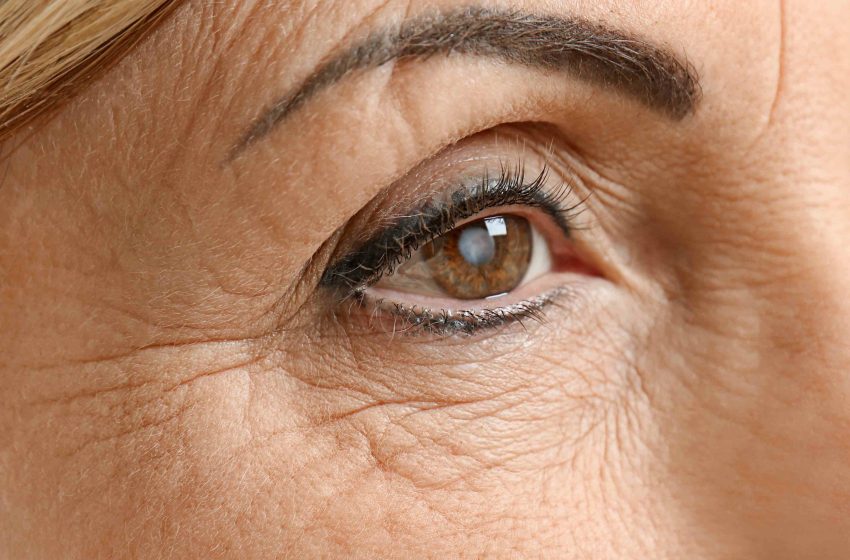  Glaucoma: doença silenciosa pode causar cegueira sem diagnóstico precoce Com 1,7 milhão de casos no Brasil, especialistas alertam para a importância de exames periódicos e início imediato do tratamento para preservar a visão.