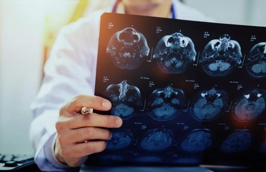  Casos de AVC crescem no Brasil e alertam para prevenção e monitoramento domiciliar Dados recentes mostram aumento de mortes e internações por Acidente Vascular Cerebral; especialistas destacam importância do controle da pressão, glicemia e uso de tecnologias domésticas para reduzir riscos.