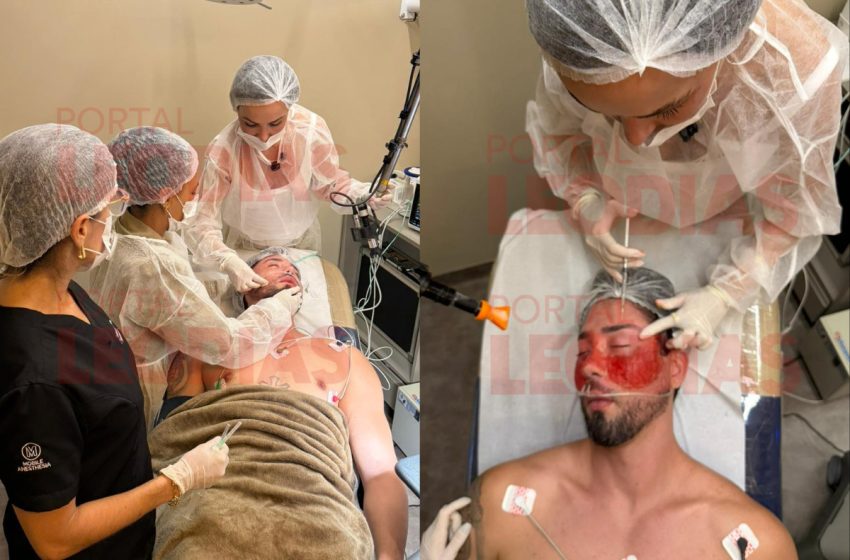  Melquiades surpreende com nova transformação estética; confira as imagens!