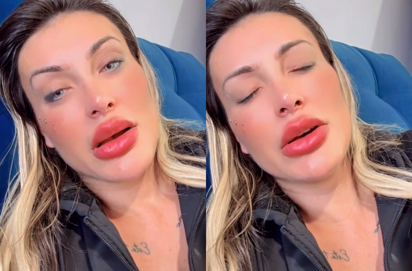  Andressa Urach mostra sua impressionante transformação facial; confira o resultado